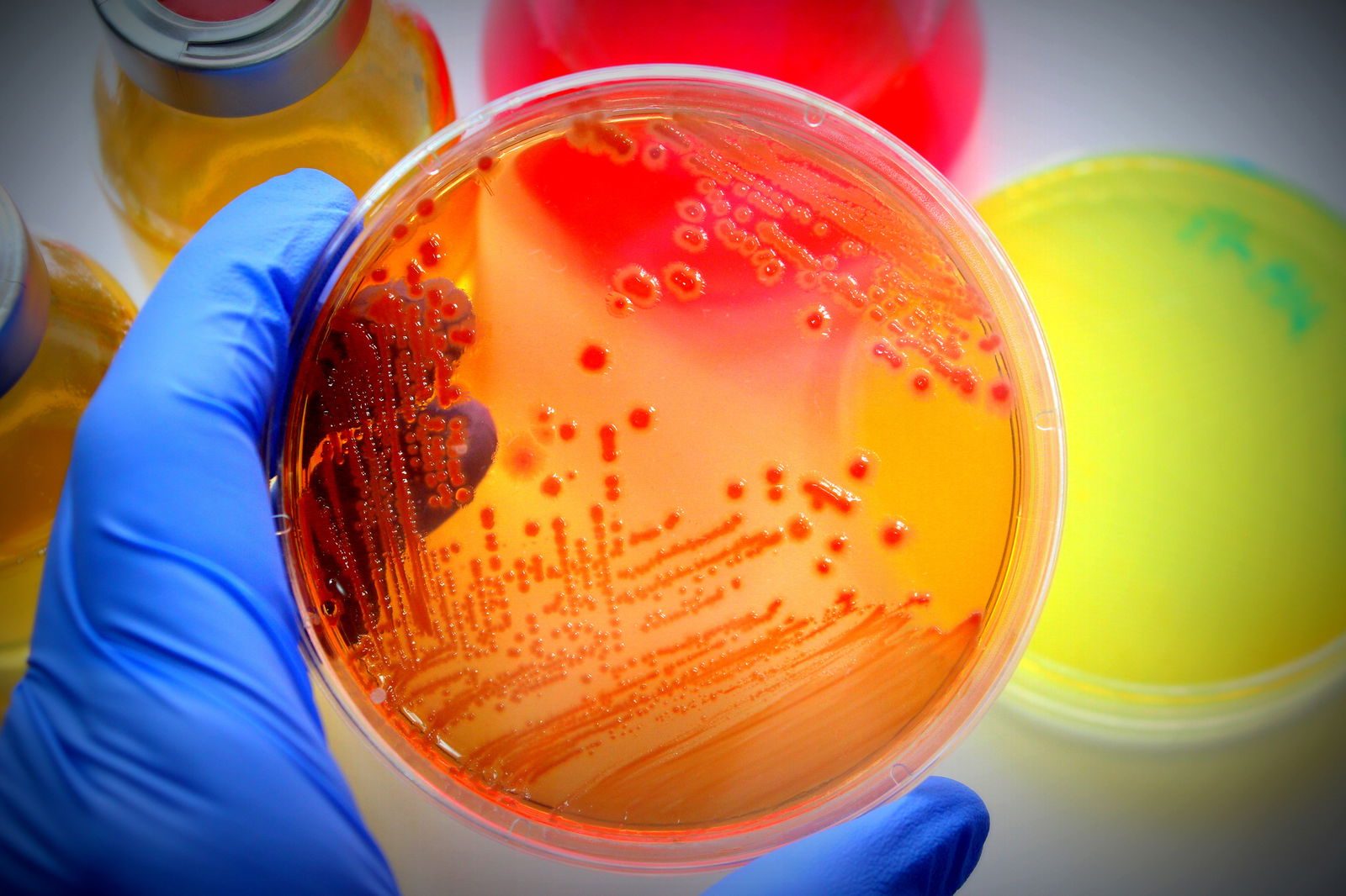 Ein Mikrobiologie hält eine orangefarbene Petrischale mit Kulturen