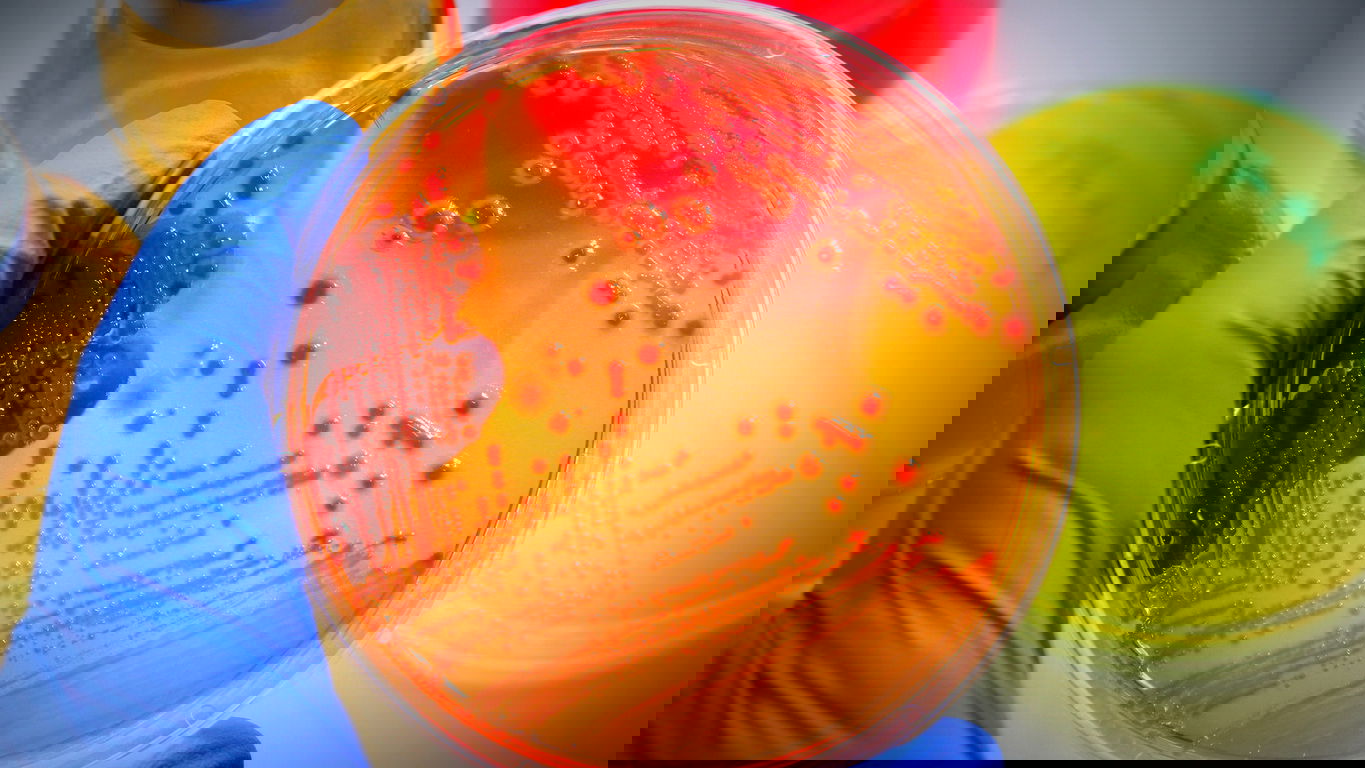 mikrobiologie-gehalt.jpg Ein Mikrobiologie hält eine orangefarbene Petrischale mit Kulturen